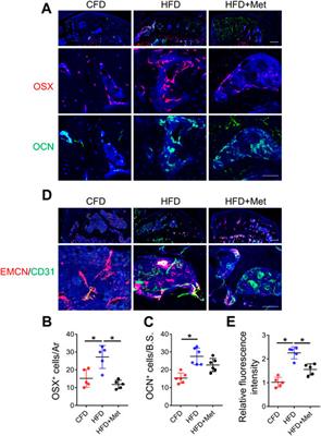 Metformin attenuates high-fat diet induced metabolic syndrome related osteoarthritis through inhibition of prostaglandins